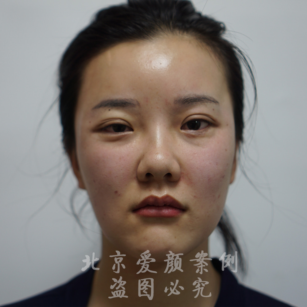 室内消火栓损坏成“摆设” 温泉消防责令整改【ky开元】(图1) ky开元